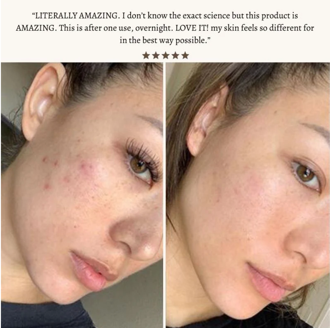 STIMULUX+™ Clinical High Frequency Wand