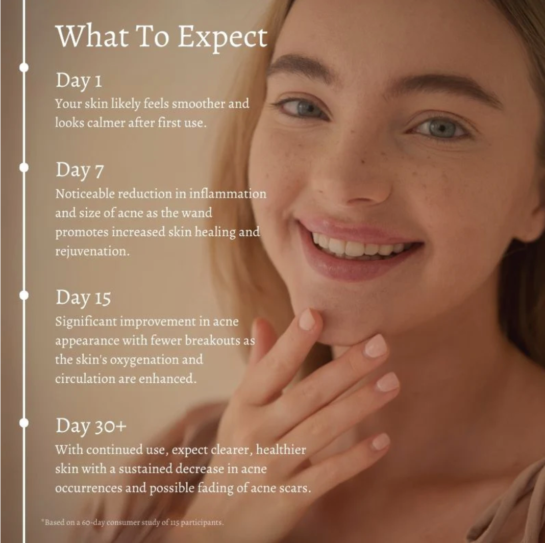 STIMULUX+™ Clinical High Frequency Wand