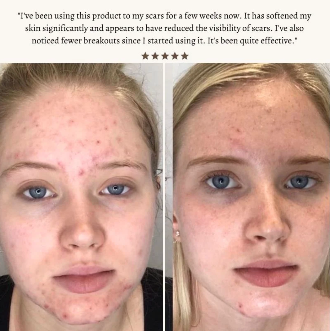 STIMULUX+™ Clinical High Frequency Wand